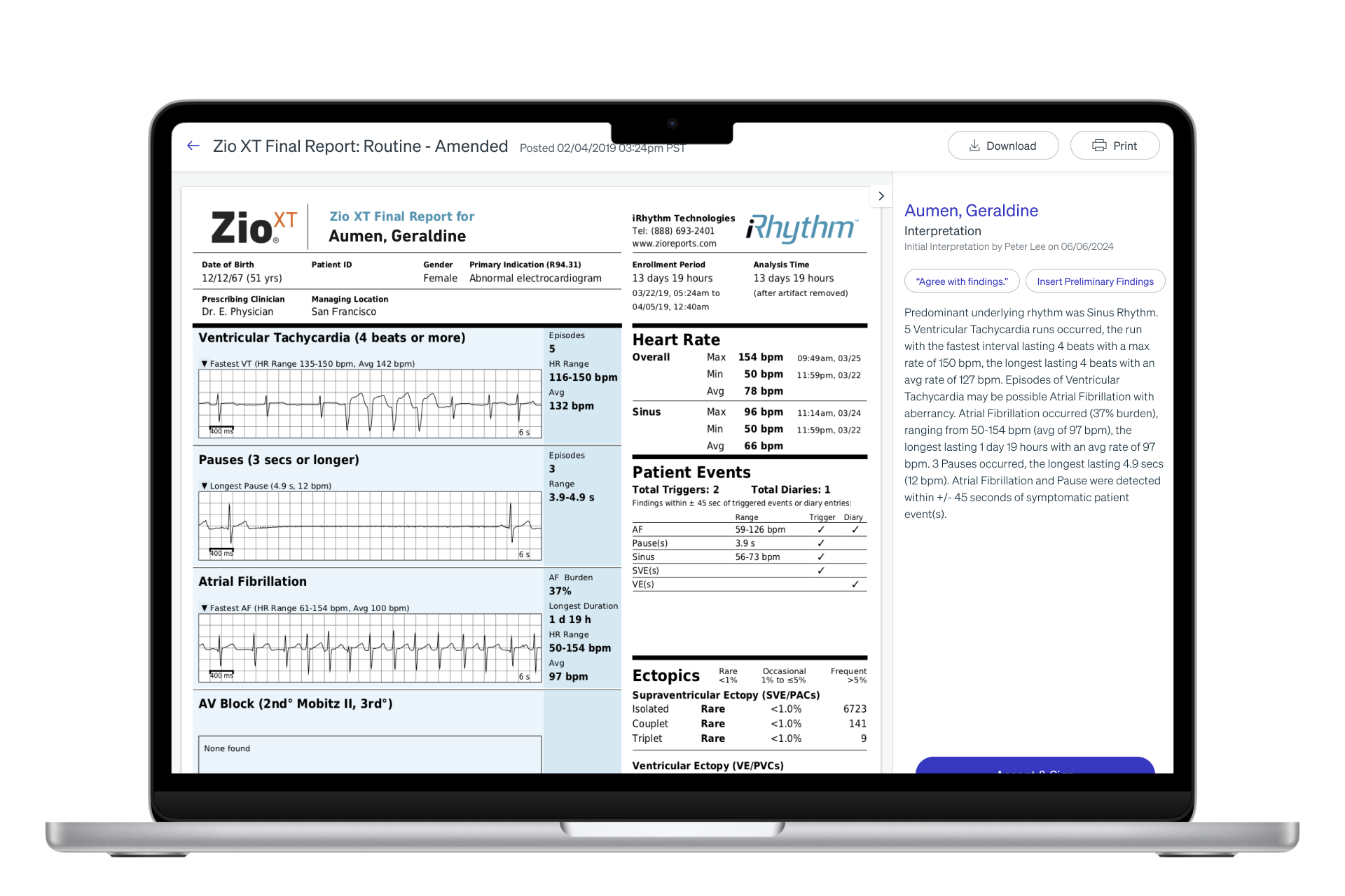 Original Zio clinical report — dense cardiology-focused layout